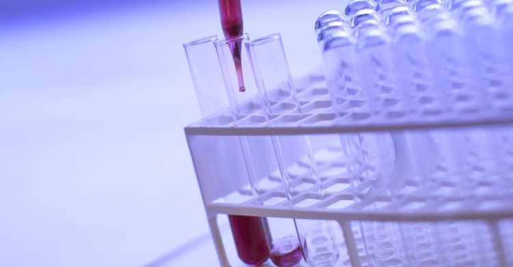 test tubes Image by Philippe Delavie from Pixabay